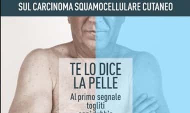 Бесплатная проверка на наличие рака кожи в Риме